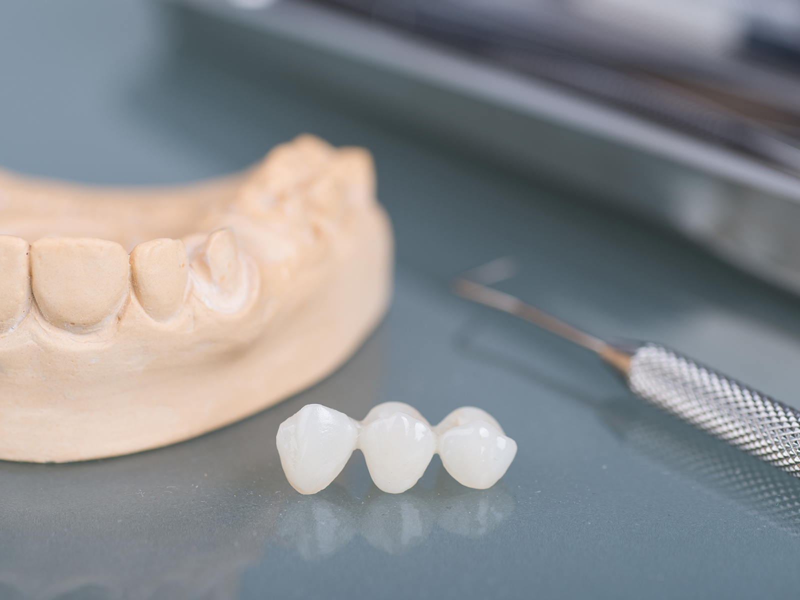 歯が欠けた・折れた